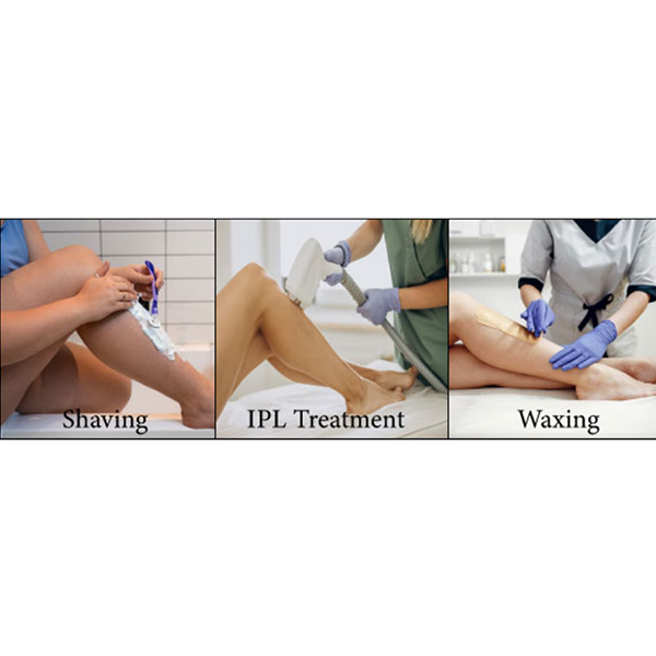 IPL Hair Removal vs. Shaving and Waxing